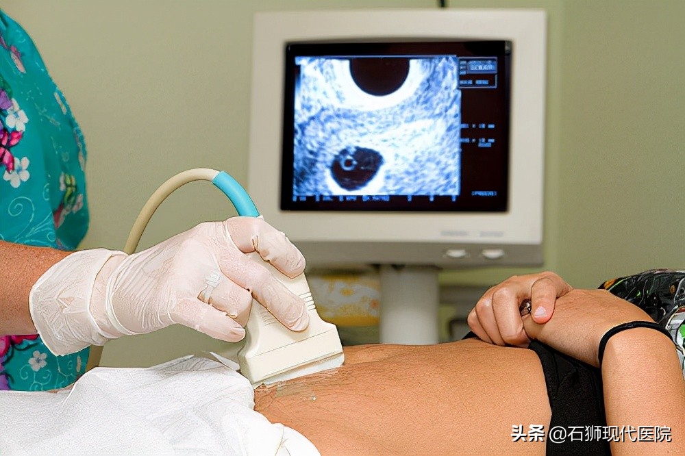 多久去医院检查一次妇科比较好?检查前要注意这2点
