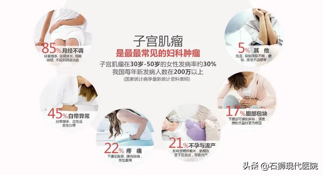 大家好，我是一枚10岁的子宫肌瘤