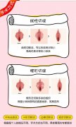 小阴唇手术到底什么时候该做？