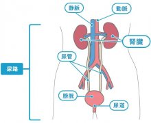 秋冬季节尿路感染高发，如何预防？你
