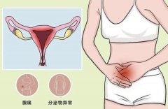 【健康科普】炎炎夏日，妇科炎症高发