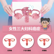 妇科 “三大杀手” 来袭：宫颈癌、内膜